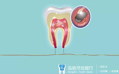 牙髓干细胞